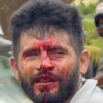 Serviços precários de saúde e educação do governo Aurélio Goiano na mira da Câmara